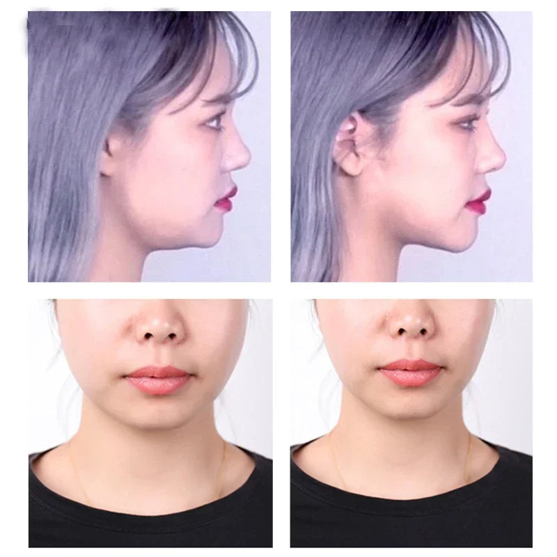 40-120PCS V-Shape Face Wrinkle Sagging Skin
